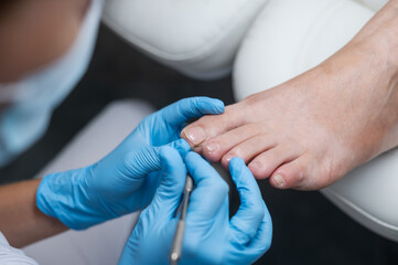nail