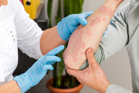 skin allergy